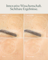 Exosome Barrier Moisturizer NEU