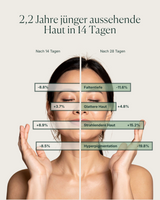 Exosome Barrier Moisturizer NEU